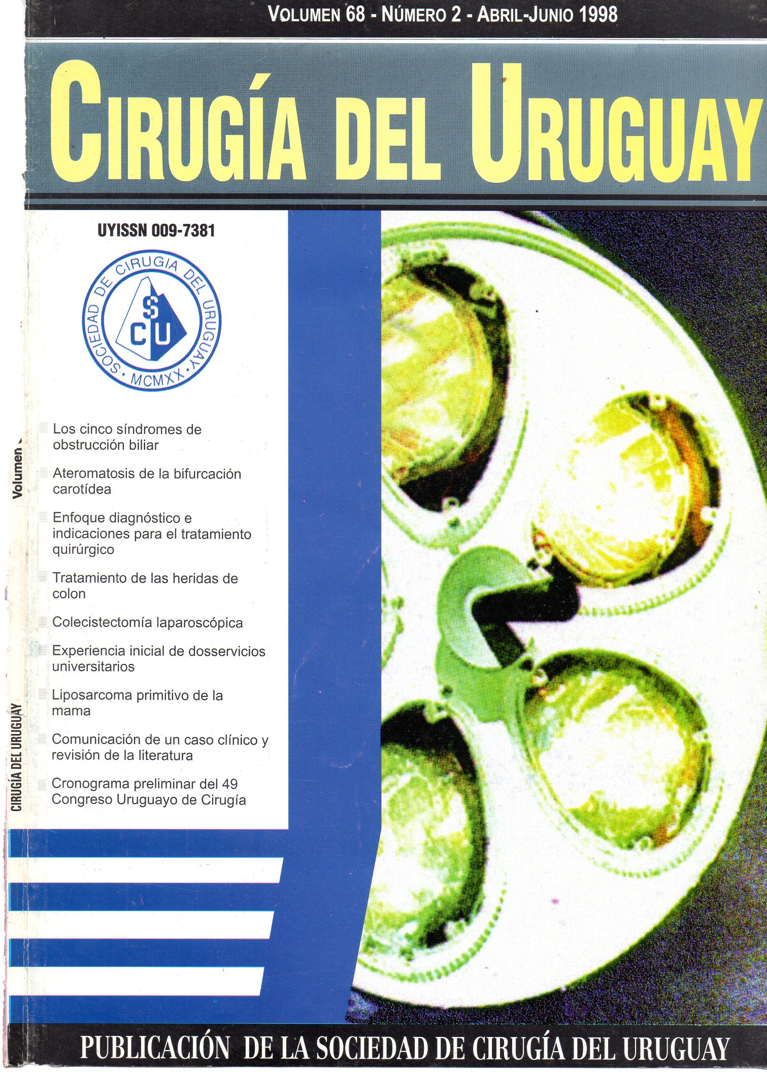 					Ver Vol. 68 Núm. 2 (1998): Cirugía del Uruguay
				