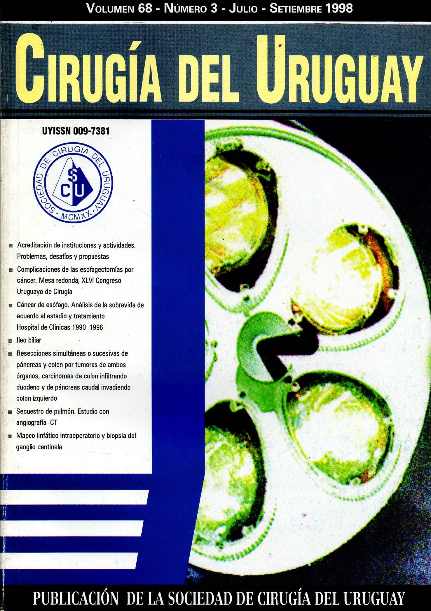 					Ver Vol. 68 Núm. 3 (1998): Cirugía del Uruguay
				