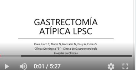 gastrectomia_atipica.jpg